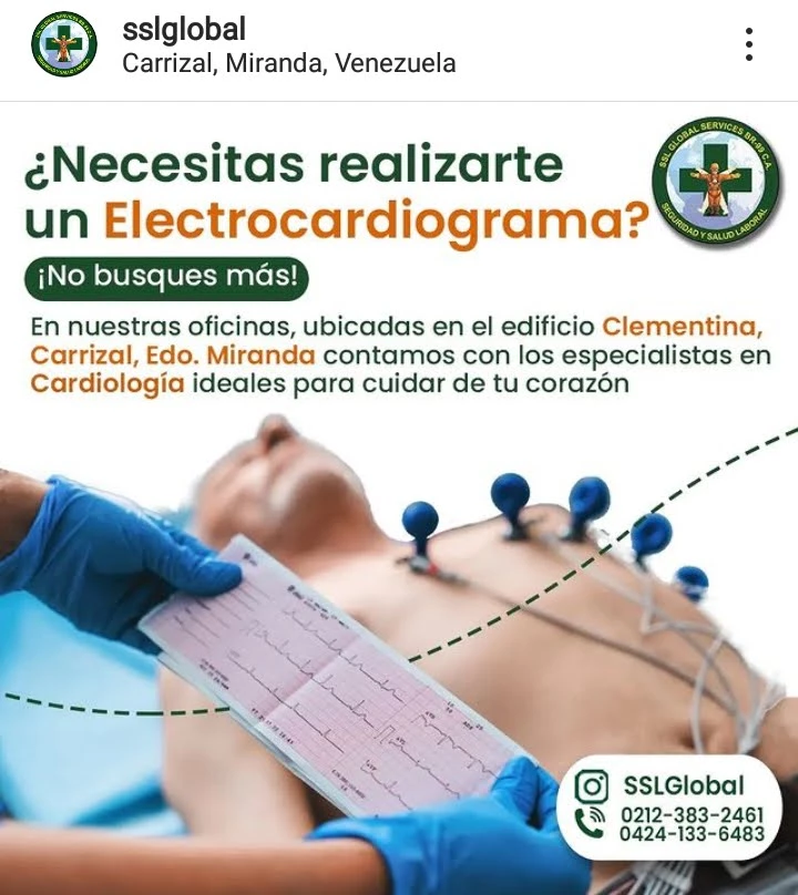 Electrocardiograma